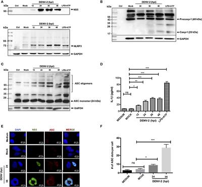 Dengue Virus Serotype 2 and Its Non-Structural Proteins 2A and 2B Activate NLRP3 Inflammasome